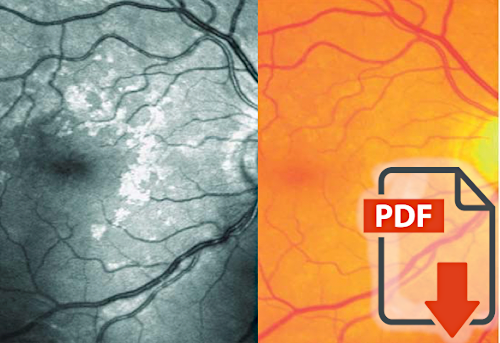 Relationship Between Retinal Glial Cell Activation in Glaucoma and Vascular Dysregulation
