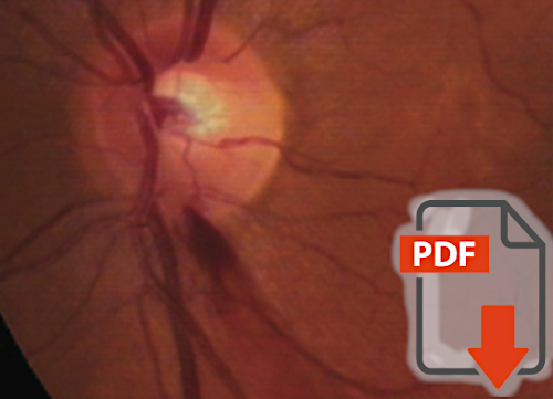 The pathogenesis of optic disc splinter haemorrhages: a new hypothesis
